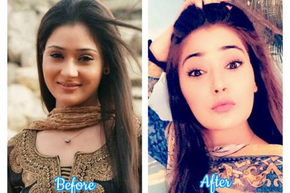 daily soap actresses who have undergone plastic surgery