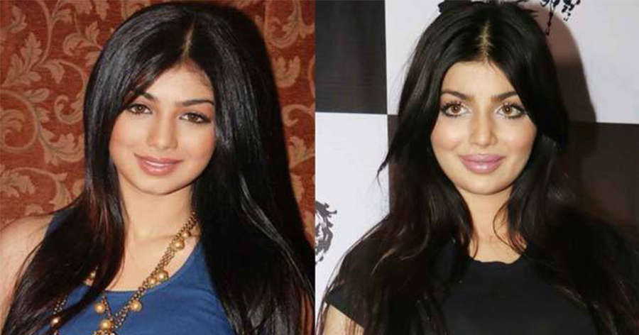 15 Celebrities Before And After Plastic Surgery And Nose Jobs, Checkout